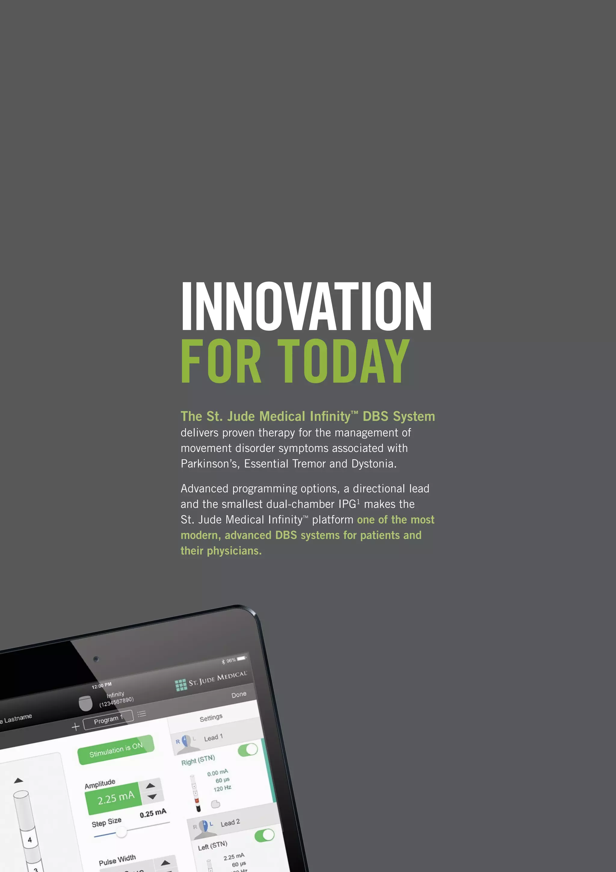 Infinity DBS System | PDF