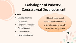 Pathologies of Puberty:
Contrasexual Developement
Causes:
• Cushing syndrome
• Acromegaly
• Exogenous androgens
• Adrenal tumors
• Ovarian tumors
• Hyperprolactinemia
Although contra-sexual
development is less common
in boys, the cause is typically
estrogen-secreting tumors
 