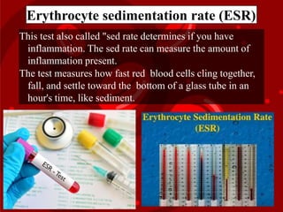 Erythrocyte sedimentation rate (ESR)
This test also called "sed rate determines if you have
inflammation. The sed rate can measure the amount of
inflammation present.
The test measures how fast red blood cells cling together,
fall, and settle toward the bottom of a glass tube in an
hour's time, like sediment.
 