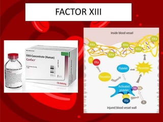 FACTOR XIII
 