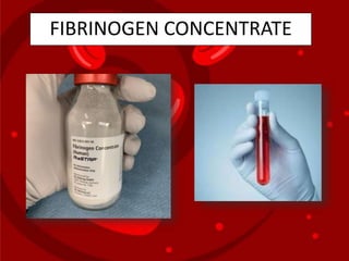 FIBRINOGEN CONCENTRATE
 