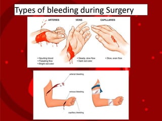 Types of bleeding during Surgery
 