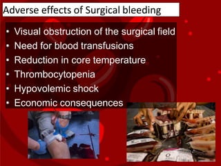 Adverse effects of Surgical bleeding
• Visual obstruction of the surgical field
• Need for blood transfusions
• Reduction in core temperature
• Thrombocytopenia
• Hypovolemic shock
• Economic consequences
 