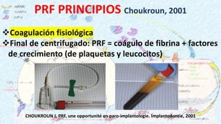 FISIOLOGIA DE LA REPARACION OSEA EN TRAUMA MAXILOFACIAL | PDF