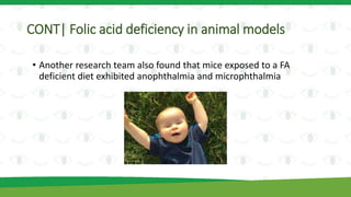 CONT| Folic acid deficiency in animal models
• Another research team also found that mice exposed to a FA
deficient diet exhibited anophthalmia and microphthalmia
 