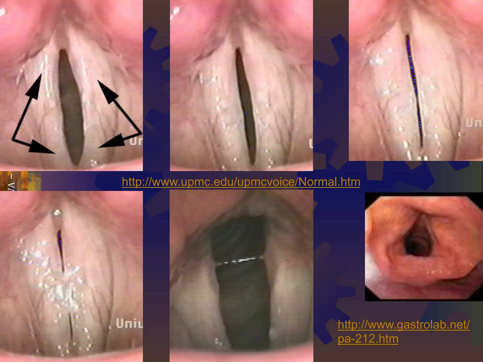 WSTĘPDOJĘZYKOZNAWSTWA–2011–KONRADJUSZCZYK
8
http://www.gastrolab.net/
pa-212.htm
http://www.upmc.edu/upmcvoice/Normal.htm
 