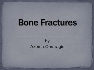 by Azema Omeragic Bone Fractures 