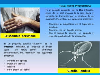 Tema: REINO PROTOCTISTA
Giardia lamblia
Leishamnia peruviana
Es un pequeño parásito causante de la
infección intestinal. Se produce al beber
agua sin hervir, comer alimentos
contaminados, etc. Presentan los siguientes
síntomas:
- Pérdida de apetito
- Dolor de cabeza
- Nausea
- Bajo grado de fiebre
Es un parásito causante de la Uta, infección
grave de la piel, mucosa de la nariz, boca y
garganta. Se transmite por la picadura de un
mosquito. Presentan los siguientes síntomas:
- Ronchitas o ampollitas en el lugar de la
picadura.
- Ronchita con un líquido seroso.
- Con el tiempo la roncha se agranda y
revienta, produciendo la ulceración.
 