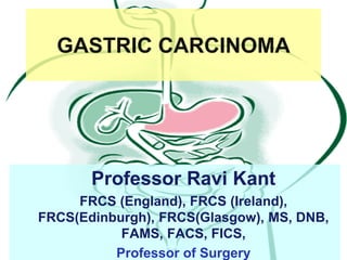 GASTRIC CARCINOMA
Professor Ravi Kant
FRCS (England), FRCS (Ireland),
FRCS(Edinburgh), FRCS(Glasgow), MS, DNB,
FAMS, FACS, FICS,
Professor of Surgery
 