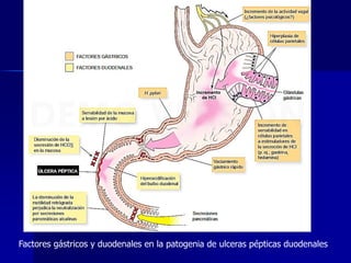 Factores gástricos y duodenales en la patogenia de ulceras pépticas duodenales
 