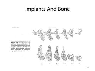 Implants And Bone
105
 