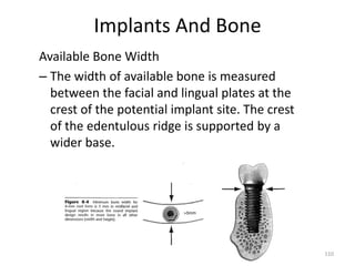 Implants And Bone
Available Bone Width
– The width of available bone is measured
between the facial and lingual plates at the
crest of the potential implant site. The crest
of the edentulous ridge is supported by a
wider base.
110
 