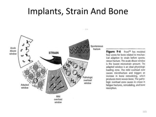 Implants, Strain And Bone
115
 