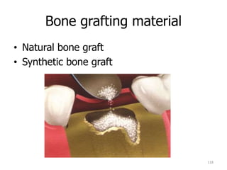 Bone grafting material
• Natural bone graft
• Synthetic bone graft
118
 