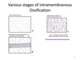 Various stages of intramembranous
Ossification
39
 
