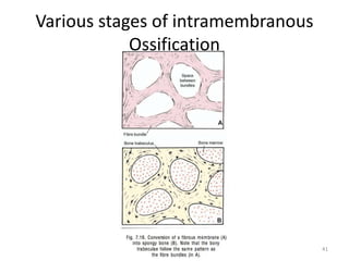 Various stages of intramembranous
Ossification
41
 