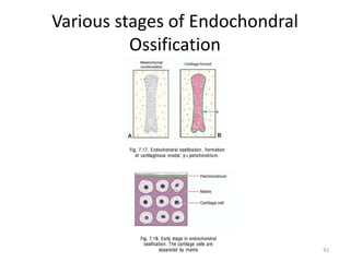Various stages of Endochondral
Ossification
42
 