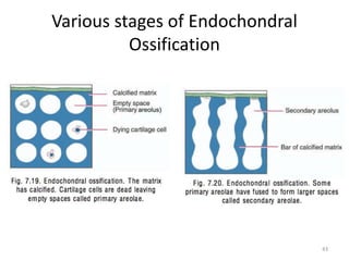 Various stages of Endochondral
Ossification
43
 