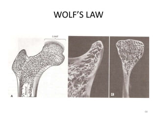 WOLF’S LAW
68
 