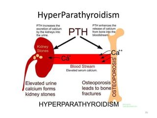 HyperParathyroidism
79
 
