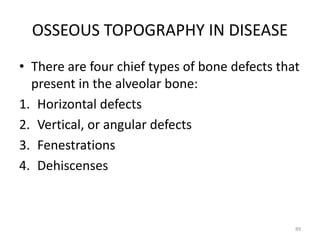 OSSEOUS TOPOGRAPHY IN DISEASE
• There are four chief types of bone defects that
present in the alveolar bone:
1. Horizontal defects
2. Vertical, or angular defects
3. Fenestrations
4. Dehiscenses
89
 