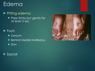 Edema
 Pitting edema:
 Press firmly but gently for
at least 5 sec
 Foot:
 Dorsum
 Behind Medial Malleolus
 Shin
 Sacral
 