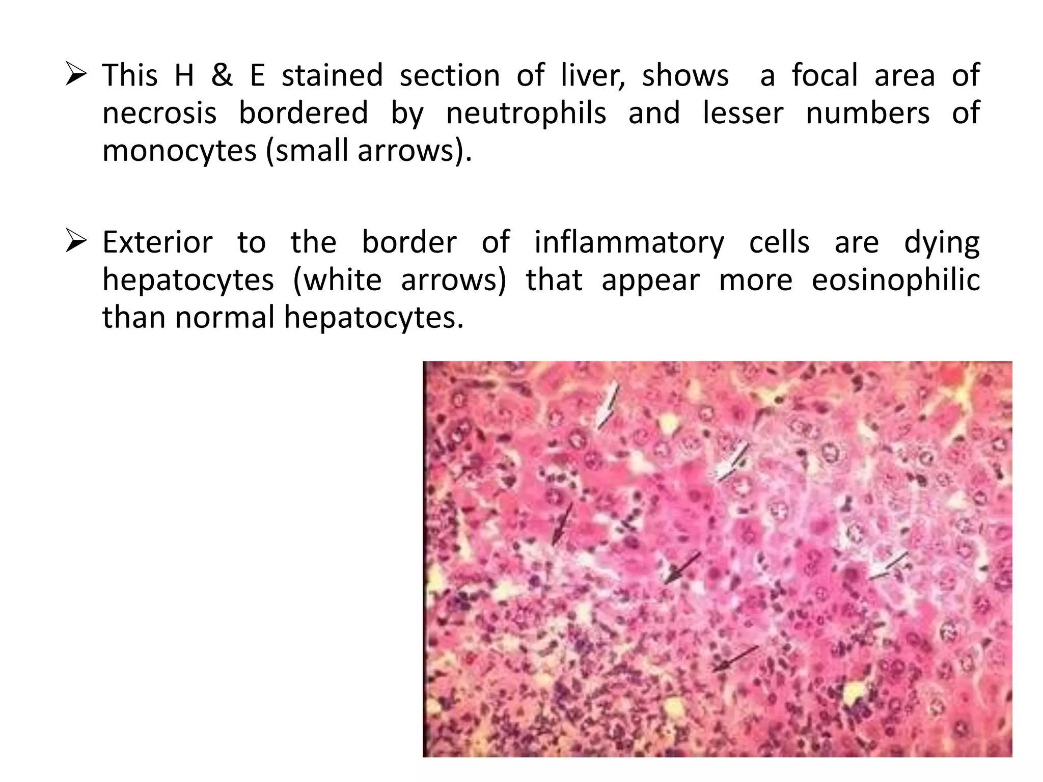 Photo inspiration: Picture Idea: Hamster Bacterial Viral Mycotic Parasitic And Non Infectious