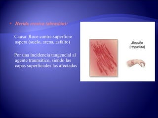 Herida erosiva (abrasión): Causa:   Roce contra superficie aspera (suelo, arena, asfalto) Por una incidencia tangencial al agente traumático, siendo las capas superficiales las afectadas 