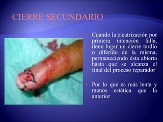 Cuando la cicatrización por primera intención falla, tiene lugar un cierre tardío o diferido de la misma, permaneciendo ésta abierta hasta que se alcanza el final del proceso reparador Por lo que es más lenta y menos estética que la anterior CIERRE SECUNDARIO 
