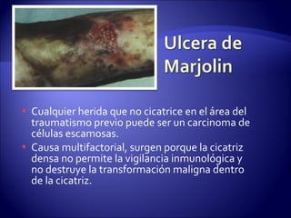 Cualquier herida que no cicatrice en el área del traumatismo previo puede ser un carcinoma de células escamosas. Causa multifactorial, surgen porque la cicatriz densa no permite la vigilancia inmunológica y no destruye la transformación maligna dentro de la cicatriz. 