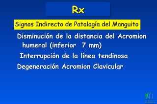 Rx
Disminución de la distancia del Acromion
humeral (inferior 7 mm)
Interrupción de la línea tendinosa
Degeneración Acromion Clavicular
Signos Indirecto de Patología del Manguito
 