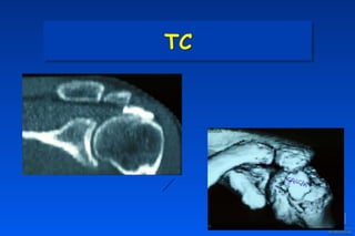 TC
 