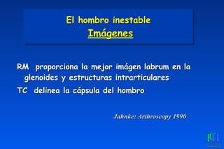 Jahnke: Arthroscopy 1990
El hombro inestable 
Imágenes
RM proporciona la mejor imágen labrum en la
glenoides y estructuras intrarticulares
TC delinea la cápsula del hombro
 