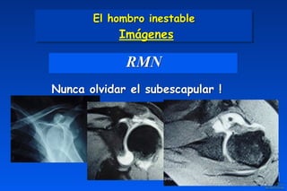 RMN
Nunca olvidar el subescapular !
El hombro inestable 
Imágenes
 