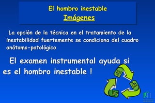 El examen instrumental ayuda si
es el hombro inestable !
La opción de la técnica en el tratamiento de la
inestabilidad fuertemente se condiciona del cuadro
anátomo-patológico
El hombro inestable 
Imágenes
 