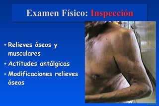 Examen Físico: Inspección
+ Relieves óseos y
musculares
+ Actitudes antálgicas
+ Modificaciones relieves
óseos
 