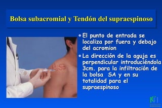 Bolsa subacromial y Tendón del supraespinoso
● El punto de entrada se
localiza por fuera y debajo
del acromion
● La dirección de la aguja es
perpendicular introduciéndola
3cm. para la infiltración de
la bolsa SA y en su
totalidad para el
supraespinoso
 