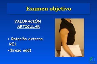 Examen objetivo
VALORACIÓN
ARTICULAR
▪ Rotación externa
RE1
▪(brazo add)
 