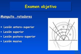 Examen objetivo
Manguito rotadores
▪ Lesión antero-superior
▪ Lesión superior
▪ Lesión postero-superior
▪ Lesión masiva
 