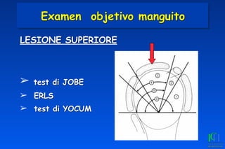 LESIONE SUPERIORE
➢ test di JOBE
➢ ERLS
➢ test di YOCUM
Examen objetivo manguito
 