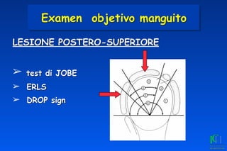 LESIONE POSTERO-SUPERIORE
➢ test di JOBE
➢ ERLS
➢ DROP sign
Examen objetivo manguito
 