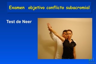 Test de Neer
Examen objetivo conflicto subacromial
 
