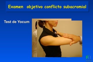 Test de Yocum
Examen objetivo conflicto subacromial
 
