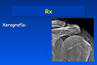 Rx
Xerografía:
 