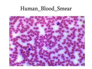 Human_Blood_Smear
 