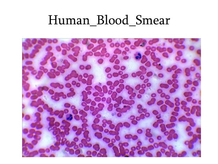 1 human blood, smear