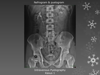 image tractus urinarius radiologi urogenital | PPTX