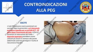 CONTROINDICAZIONI
ALLA PEG
ASCITE
«I tubi PEG possono essere posizionati con
successo dopo la paracentesi, se il riaccumulo
può essere impedito per un periodo di 7 - 10
giorni dopo l'inserimento del tubo, al fine di
consentire la maturazione del tratto. I
dispositivi gastropex potrebbero essere
utilizzati per fissare lo stomaco alla parete
addominale anteriore e mitigare il rischio di
riaccumulo di liquidi.»
 
