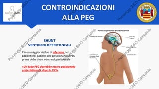 CONTROINDICAZIONI
ALLA PEG
SHUNT
VENTRICOLOPERITONEALI
C’è un maggior rischio di infezione nei
pazienti nei pazienti che posizionano la PEG
prima dello shunt ventricoloperitoneale
«Un tubo PEG dovrebbe essere posizionato
preferibilmente dopo la VPS»
 