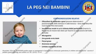 LA PEG NEI BAMBINI
Heuschkel, R B et al. “ESPGHAN position paper on management of percutaneous endoscopic gastrostomy in children and adolescents.” Journal of
pediatric gastroenterology and nutrition vol. 60,1 (2015): 131-41.
CONTROINDICAZIONI RELATIVE
• Cifoscoliosi da moderate a gravi (possono determinale il
posizionamento dello stomaco in sede toracica – Sono state descritte
inserzioni di PEG intercostali)
• Insufficienza renale in cui è richiesta dialisi peritoneale (inserire la
PEG prima di iniziare tale dialisi per favorire la maturazione del tratto
stomale)
• Microgastria
• Una grande ernia iatale
• Psicosi grave
• Anoressia nervosa
• Limitata aspettativa di vita
 